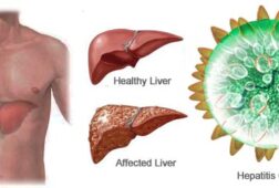 Viêm gan C có nguy hiểm không? Cách trị bệnh hiệu quả
