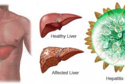 Viêm gan C có nguy hiểm không? Cách trị bệnh hiệu quả