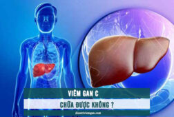 Viêm gan C có chữa được không? Cách trị bệnh hiệu quả
