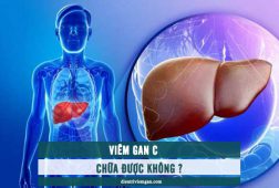 Viêm gan C có chữa được không? Cách trị bệnh hiệu quả